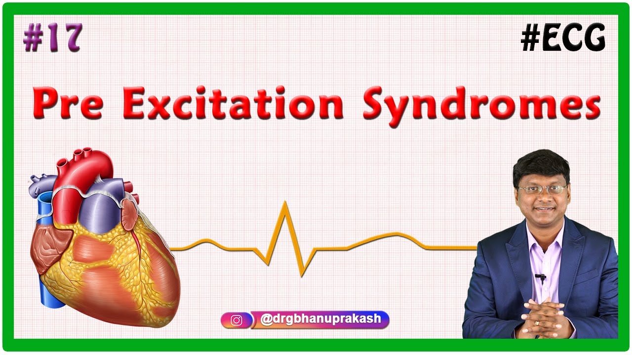 17. Pre Excitation Syndromes ( Lown-Ganong-Levine syndrome & Wolff-Parkinson-White (WPW) pattern )