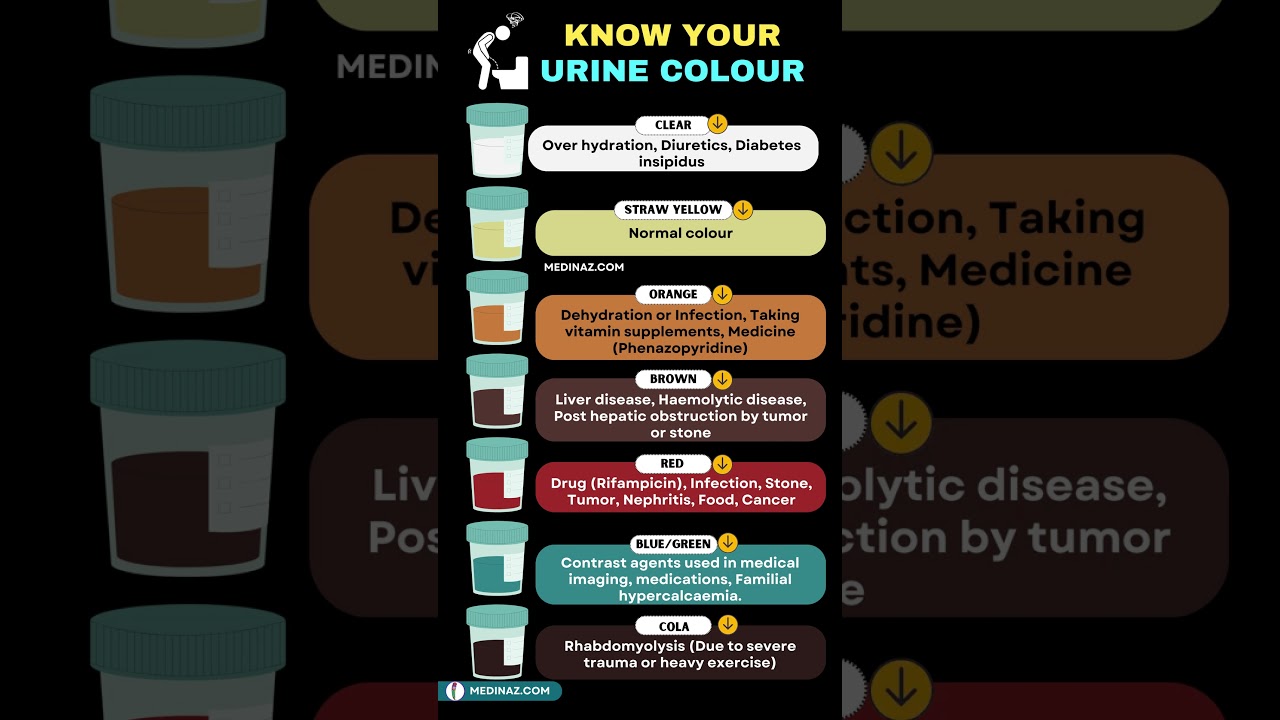 Colour of urine and what it means | Urine color | Red urine #shortsfeed #redurine #shorts