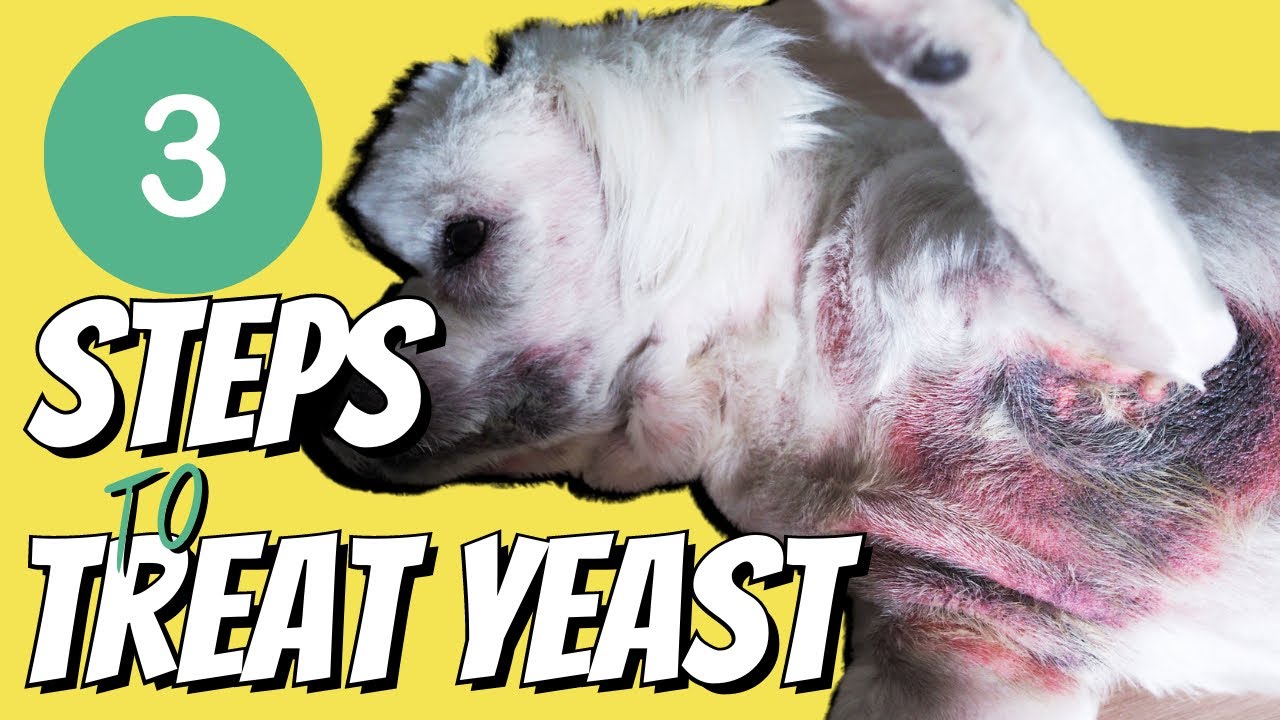 Top 3 Steps to Stop the Itching caused by Yeast