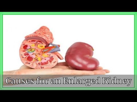 Causes for an Enlarged Kidney|Kidney deseases| Very Well