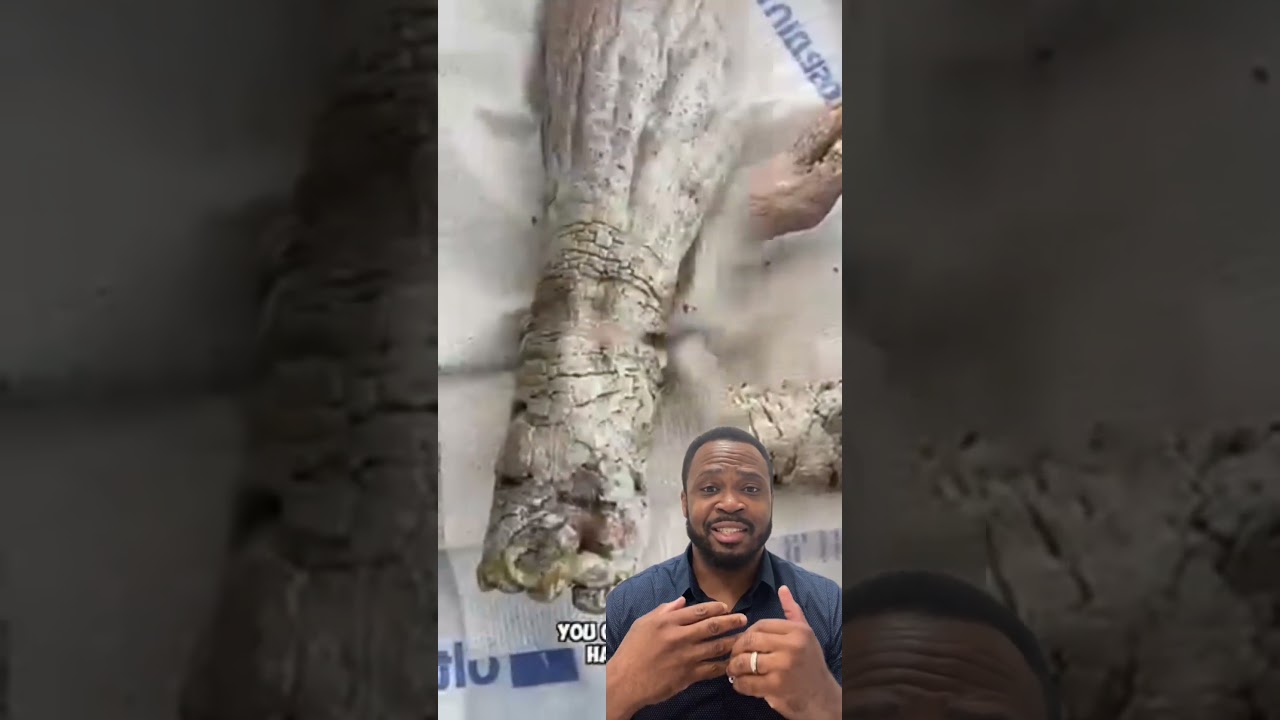 He didn’t shower for 5 YEARS! Doctors reaction #shorts