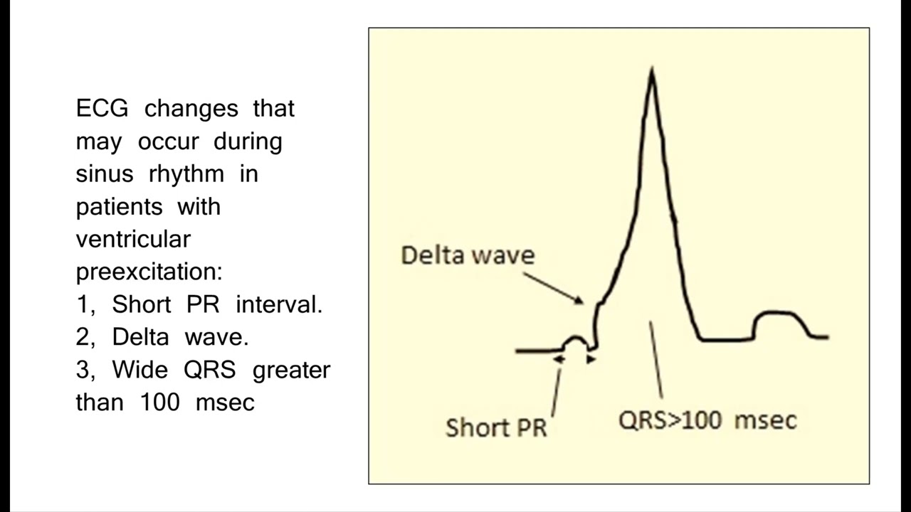 20 Ventricular Preexcitation