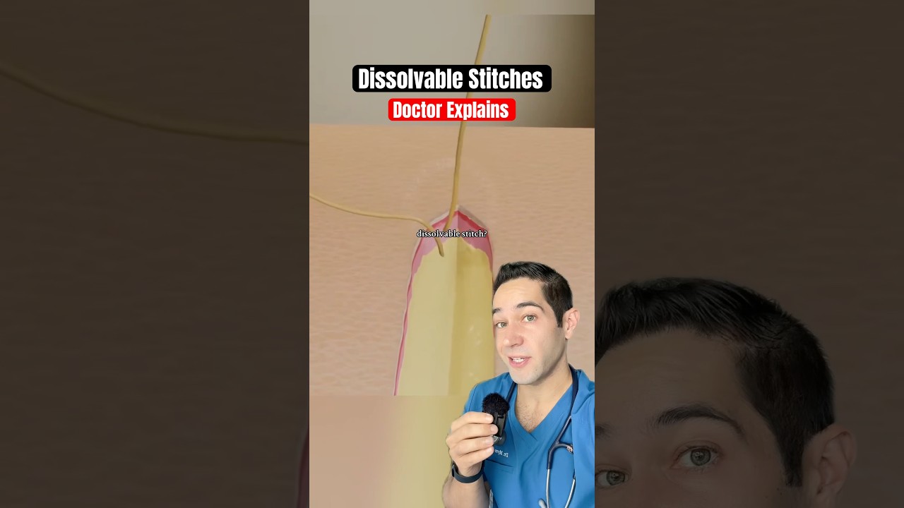 Doctor Explains: dissolvable stitches