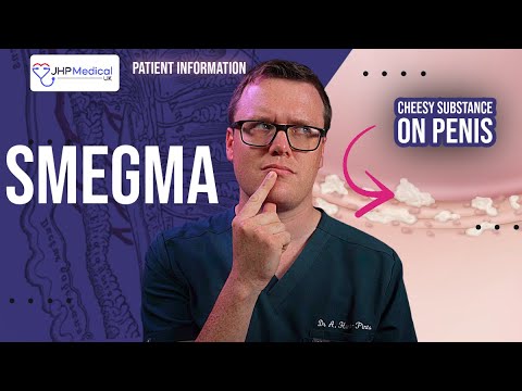 Doctor Explains SMEGMA | White / Yellow Cheesy Substance on your Penis | Treatment and Prevention