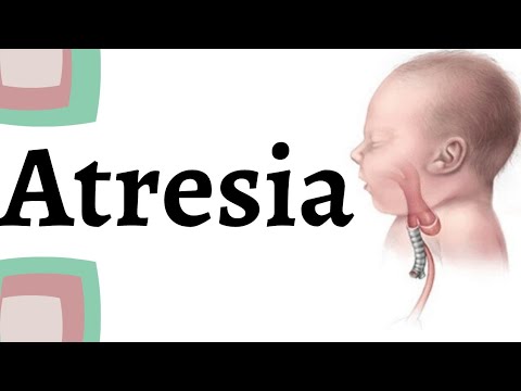 Atresia | Examples of Atresia | #atresia #kktutorialsbiology #kkbiology