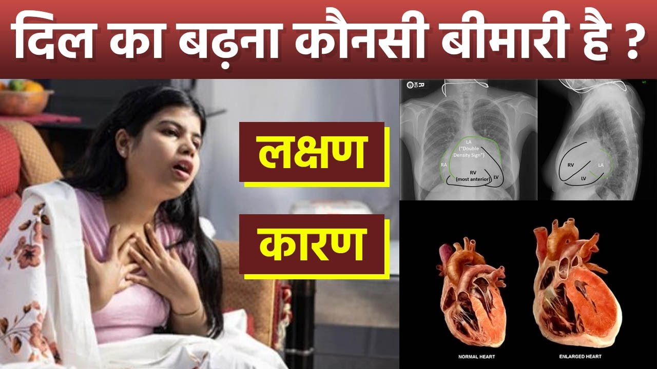 Heart Enlargement Symptoms: Dil Badha Hone Ke Lakshan | दिल का बड़ा होना कौनसी बीमारी | Boldsky