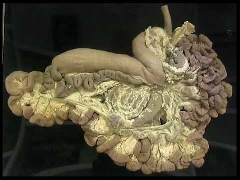 The Small and Large intestine of the Ruminant by Royal Veterinary College-Veteology.wmv